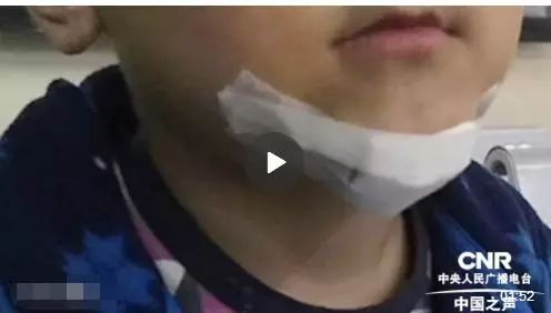 孩子去世五天后，办公室小野道歉了