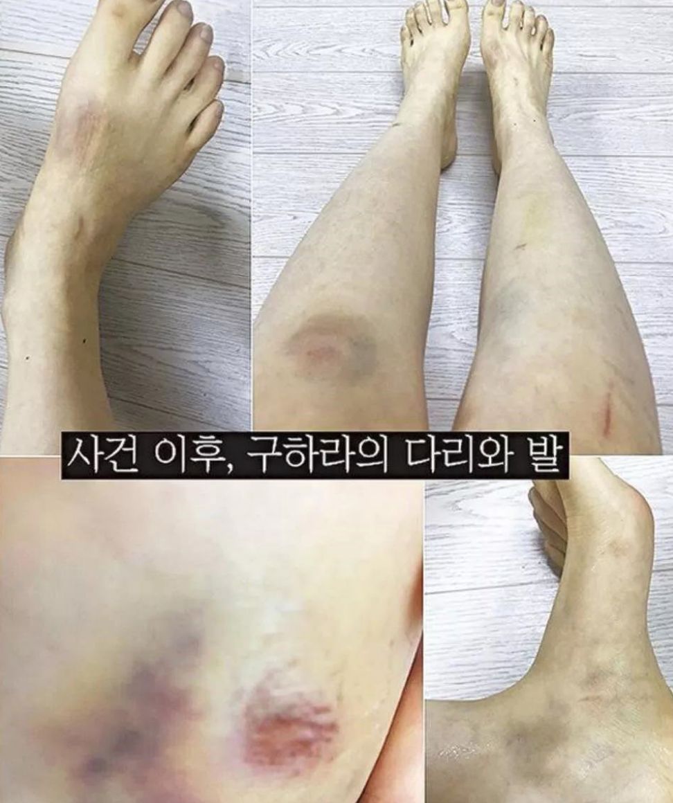 美丽，富有，年少成名，她为何选择死亡？