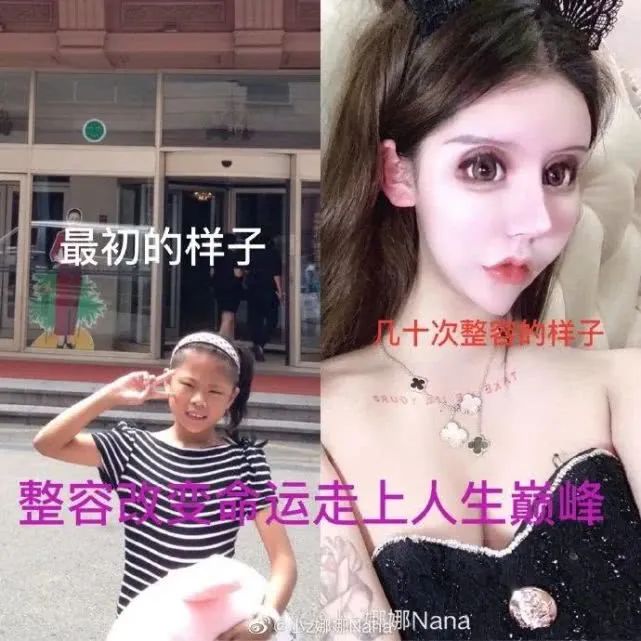 我花了100万把女儿整成残废，病态审美观正在摧残20万女性