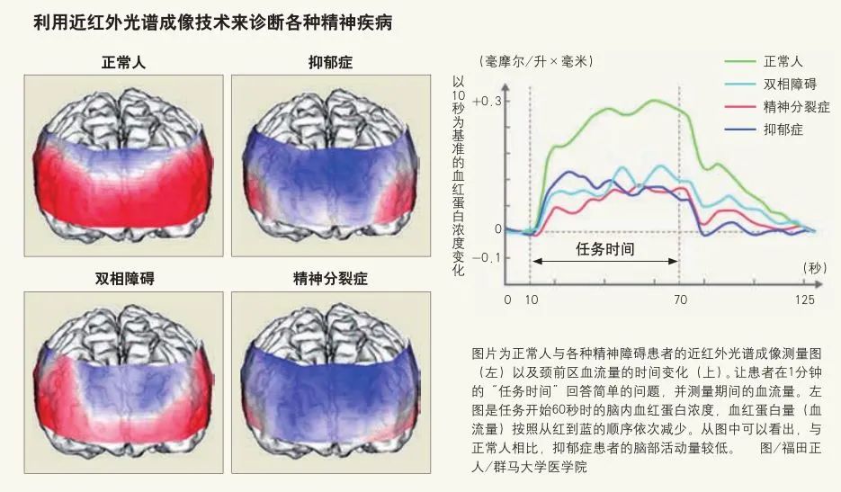 长期心情低落，我是不是抑郁症了？