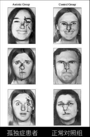 眼动地形图、早期鉴别孤独症孩子的重大发现