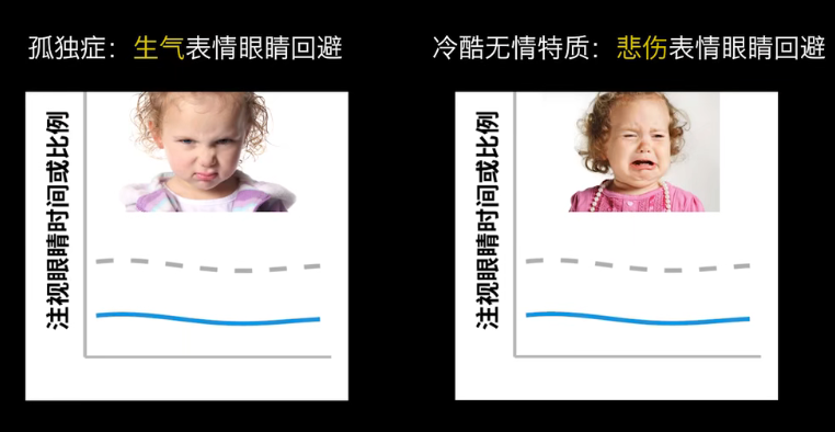 眼动地形图、早期鉴别孤独症孩子的重大发现