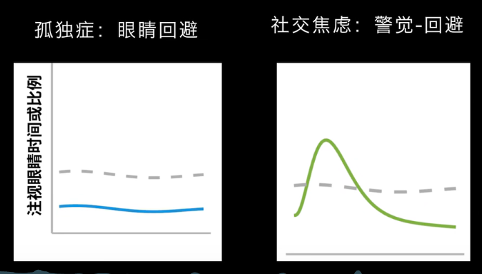 眼动地形图、早期鉴别孤独症孩子的重大发现